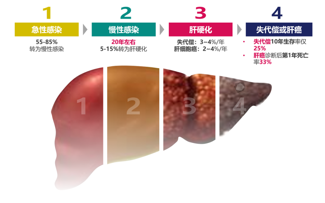 悄悄变成肝硬化、肝癌，很多人感染了却不知道